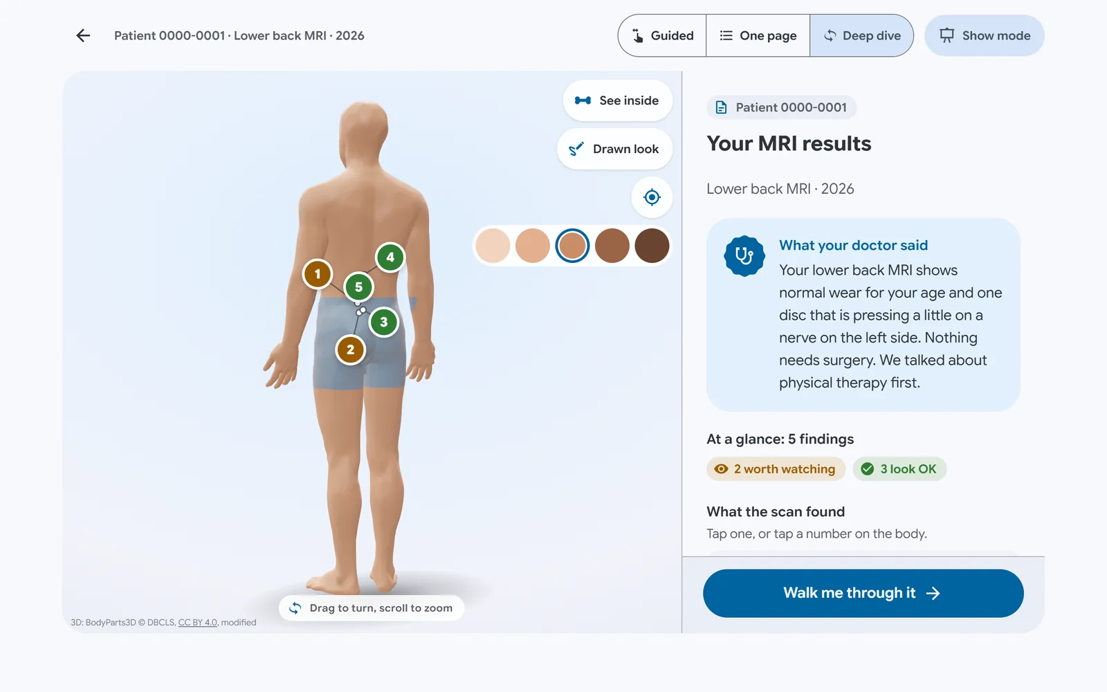 The Deep dive: each finding pinned on a 3D body the patient can turn.